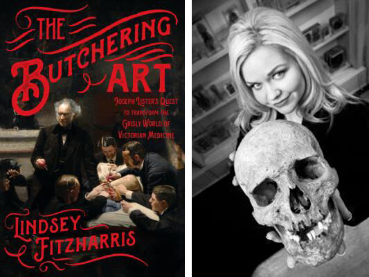 Image of the book cover for The Butchering Art by Lindsey Fitzharris. Image of Lindsey Fitzharris holding a scull.
